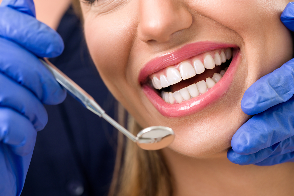Professional Dental Exam for Bright Smile – Invisalign Irvine A close-up of a dentist examining clean, healthy teeth with precision tools – Invisalign Irvine