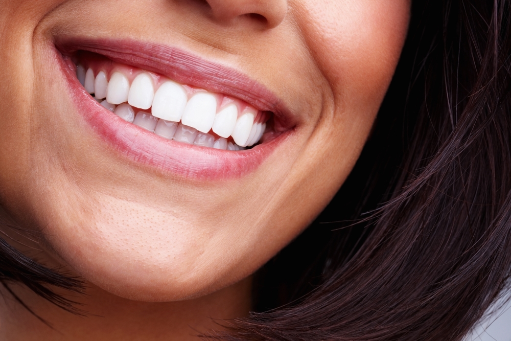 Bright Smile After Cosmetic Veneers A detailed close-up of a healthy, radiant smile showcasing the bright and even appearance