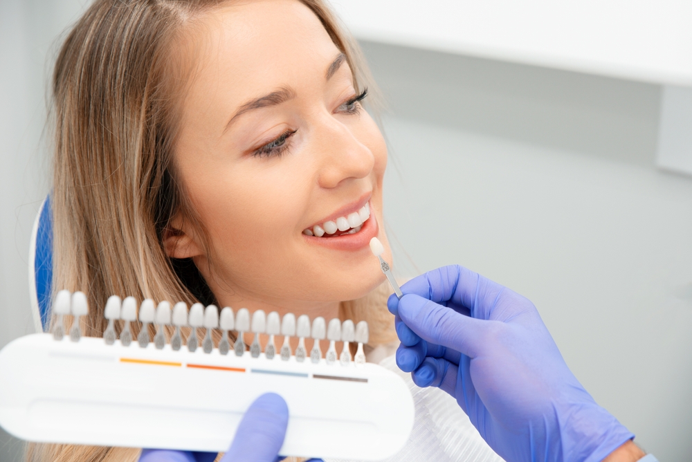 Shade Matching for Veneers Consultation - Porcelain Veneers Orange County A dentist carefully matches tooth shades to create natural-looking porcelain veneers for a bright, seamless smile - Porcelain Veneers Orange County